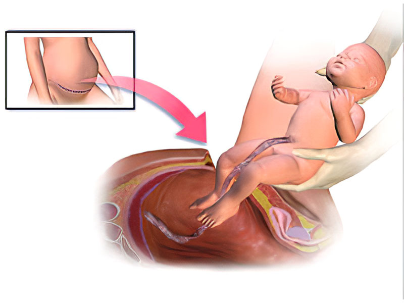img-1 Best Gynecologist in Jaipur