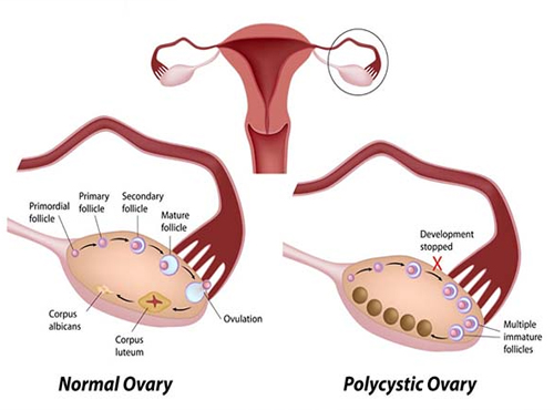 s8 Best Gynecologist in Jaipur